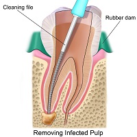 Child Dentistry